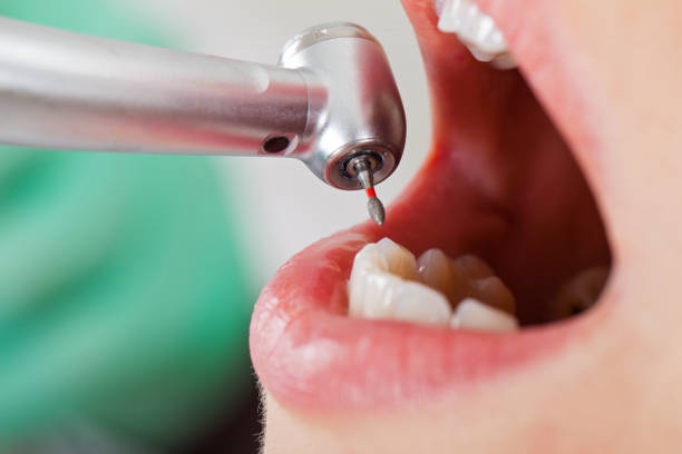 Best Emergency Treatment for Jaw Pain or Injury in Aromas, CA